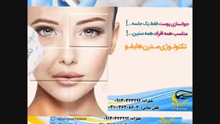 هایفوتراپی آکنه