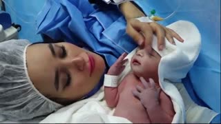 عمل جراحی زایمان سزارین