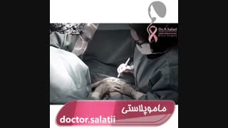 فیلم واقعی ماموپلاستی