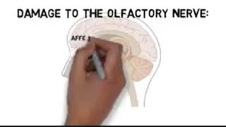 اعصاب مغزی و اسیب به ان