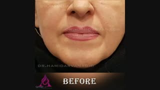 فلیم واقعی اصلاح خط خنده