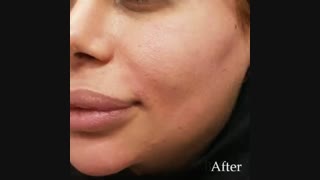 فیلم واقعی کانتورینگ گونه
