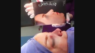 فیلم واقعی عمل بینی بزرگ با انحراف شدید