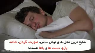 استفاده از آلوئه ورا برای درمان جای نیش ساس | سم ساس کش قوی