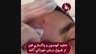 فیلم تخلیه کومدون