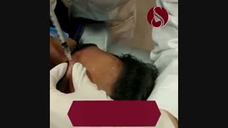 فیلم تزریق بوتاکس به صورت آقایان