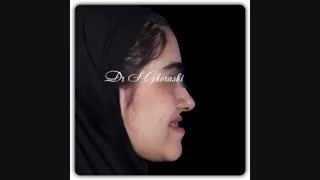 درمان ارتودنسی همراه با جراحی فک | دکتر سعید قریشی