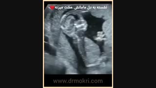 فیلم واقعی حرکت جنین در هفته 14 ام الی 16 ام