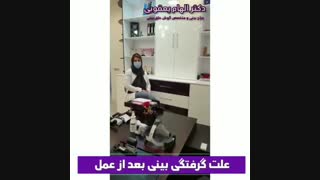 علت گرفتگی بینی بعد از عمل