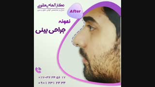 عمل بینی