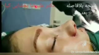 فیلم عمل بینی استخوانی