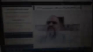دکتر نوری محمد زاده رییس‌ مرکز ایران شناسی دانشگاه دولتی داغستان کربوکسی تراپی