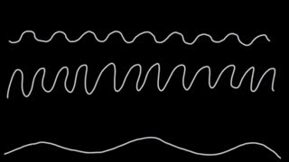 Introduction to Point of Care Ultrasound (POCUS) - Basics