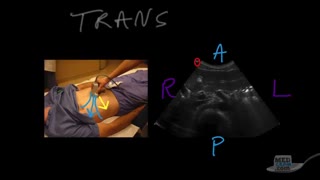Ultrasound Principles & Instrumentation - Orientation & Imaging Planes