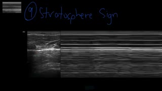 Lung Ultrasound Explained (Point of Care, Bedside, Clinical)