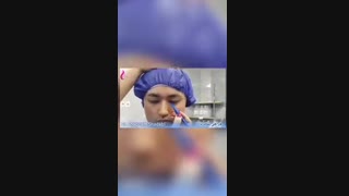 جراحی بلفاروپلاستی