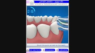 روش استفاده از مسواک برقی | دکتر احسان مهریزی