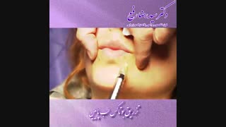 تزریق بوتاکس لب پایین | دکتر سید رضا رفیع | جراح پلاستیک تهران