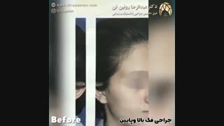 جراحی فک بالا و پایین | فوق تخصص جراحی پلاستیک | دکتر عبدالرضا روئین تن