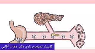 دیابت چیست؟