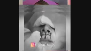 عمل سانترال لب