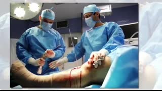 ویدئو واقعی جراحی ترمیم پارگی ریشه مینیسک زانو