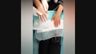 تزریق چربی پشت دست رفع غبغب
