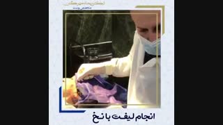 لیفت صورت بدون جراحی دندان شیری