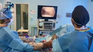 جراحی آرتروسکوپی لابروم شانه