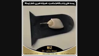پست های بلند و ظاهرا مناسب همیشه هم بی خیر نیستا | دکتر لیلا عطایی