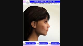 لبخند لثه ای | دکتر احسان مهریزی