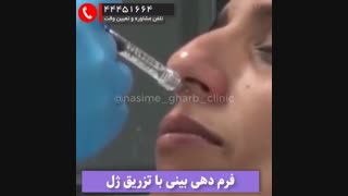 فرم دهی بینی با تزریق ژل