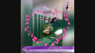 فیلم زایمان در اتاق عمل