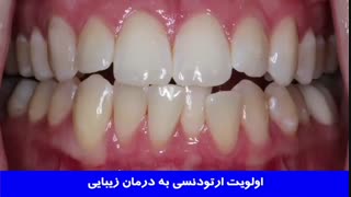 ارتودنسی یا درمانهای دندانپزشکی زیبایی؟ | دکتر احسان مهریزی