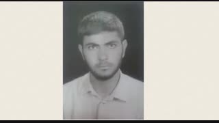 مهران بلورچی دندان شیری