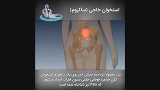 استخوان خاجی ( ساکروم ) | متخصص ارتوپد | دکتر محمد ابراهیم طاهریان