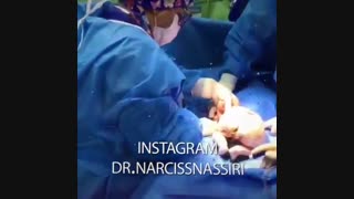 فیلم سزارین