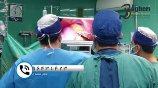 فیلم واقعی و بدون سانسور اسلیو معده در خانم 67 ساله