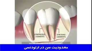 آیا ارتودنسی محدودیت سن دارد؟ | دکتر احسان مهریزی