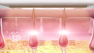 نحوه عملکرد لیزر موهای زائد