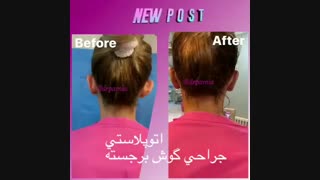 جراحی زیبایی گوش