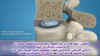 دیسککتومی قسمت تحتانی کمر | متخصص ارتوپد | دکتر محمدابراهیم طاهریان