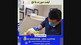 لیفت صورت با نخ