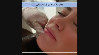 اصلاح فرم لب