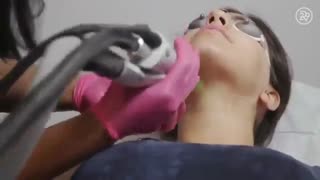 لیزر موهای زائد درمان جای جوش