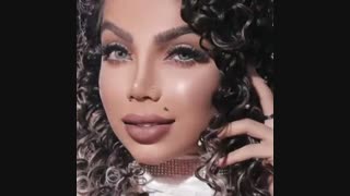 جراحی نیمه فانتزی بینی 5 سال بعد از عمل