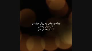 نمونه جراحی بینی نیمه فانتزی