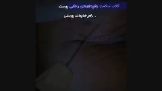 معجزه پلکسر پلاس فرکشنال