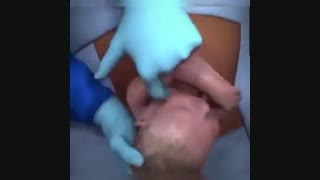 فیلم عمل سزارین از شروع تا پایان