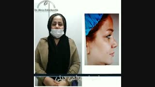 عمل بینی ترمیمی - ترمیم بینی منگنه ای